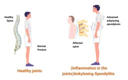 Understanding Knee Pain: Causes, Prevention, and Treatment