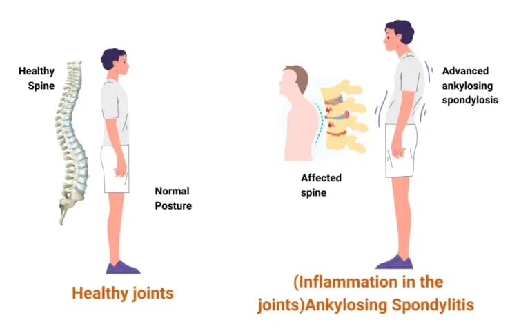 Understanding Knee Pain: Causes, Prevention, and Treatment