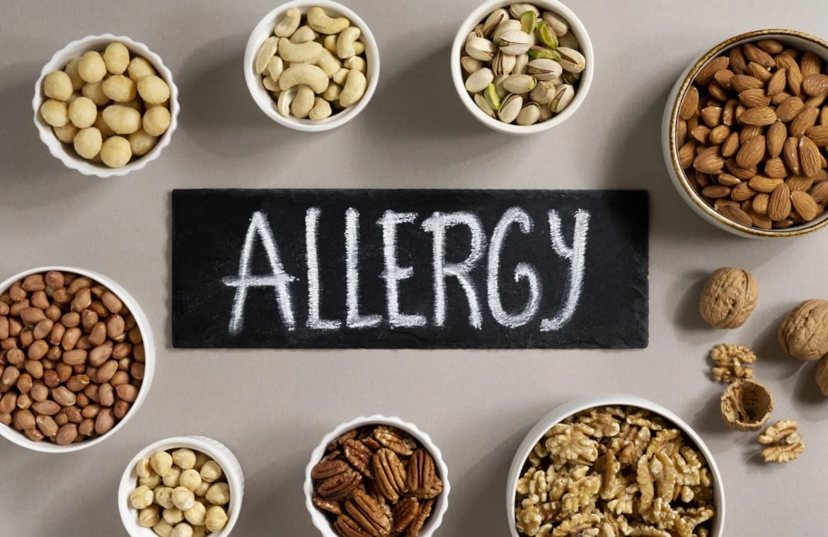 Food Allergy