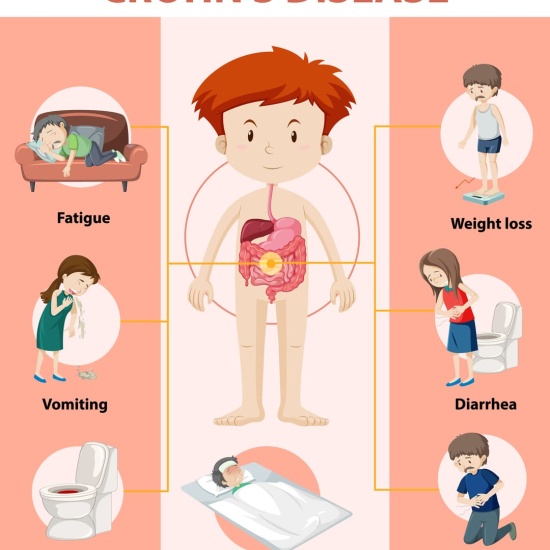 Crohn's Disease